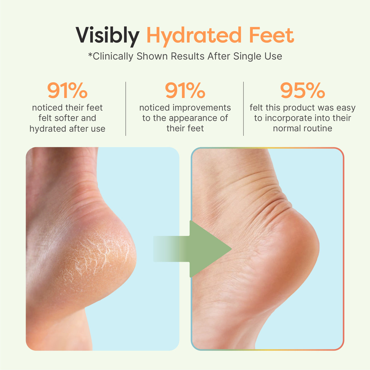 Fuzzy Moisturizing Gel Heel Socks - Spring Variety Pack - ZenToes