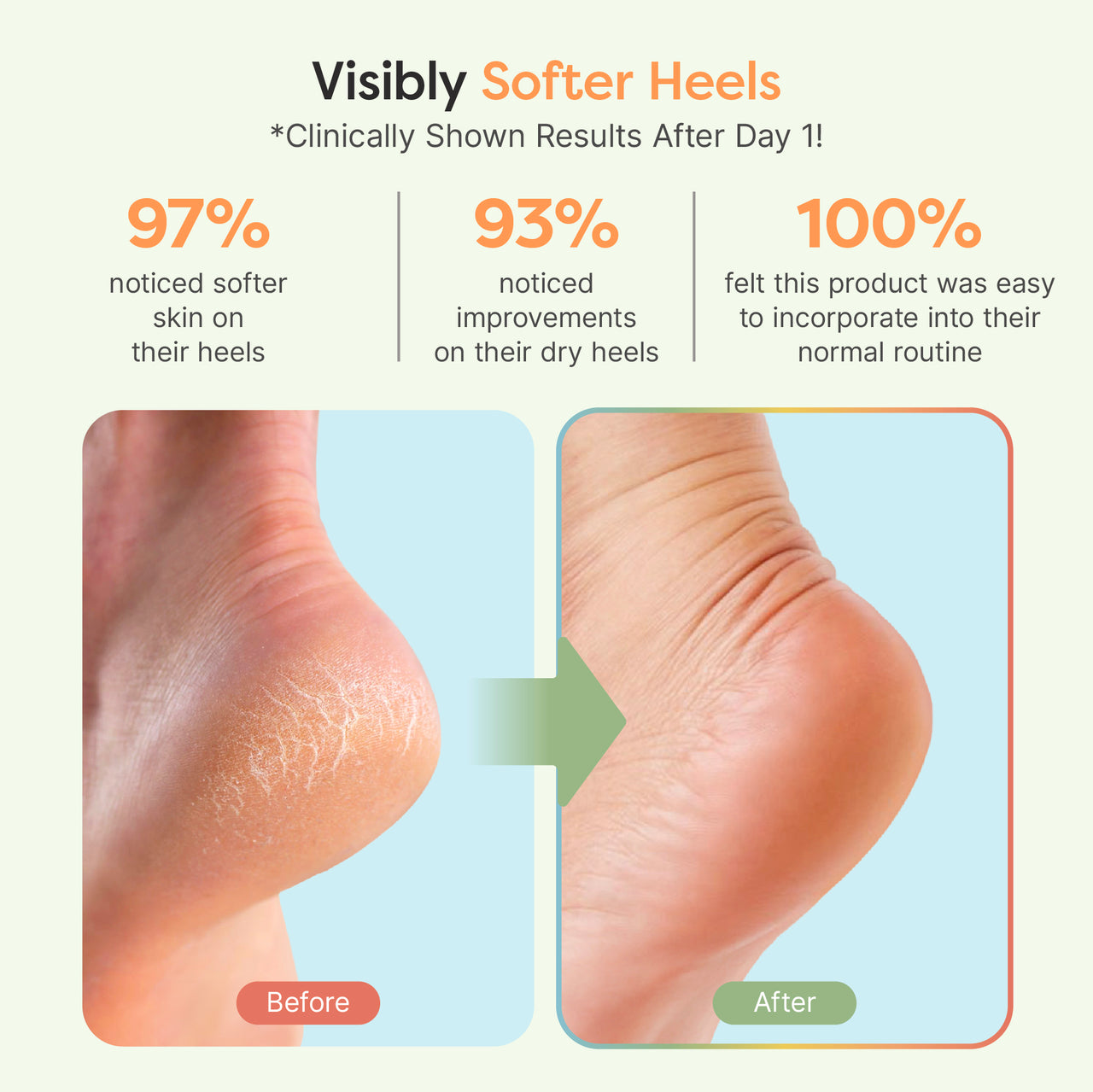 Moisturizing Gel Heel Socks - Fuzzy